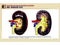 Рельефная таблица "Почка. Фронтальный разрез" (формат А1, матовое ламинирование) - fgospostavki.ru - Махачкала