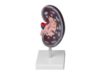 Модель почки в разрезе - fgospostavki.ru - Махачкала