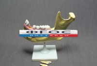 Модель "Челюсть разборная" - fgospostavki.ru - Махачкала