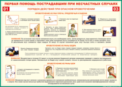 Таблица "Порядок действий при опасном кровотечении" (100х140 сантиметров, винил) - fgospostavki.ru - Махачкала