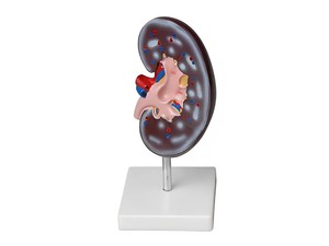 Модель почки в разрезе - fgospostavki.ru - Махачкала