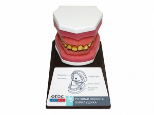 Демонстрационная модель "Ротовая полость курильщика" - fgospostavki.ru - Махачкала