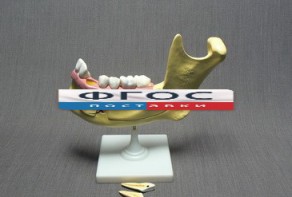 Модель "Челюсть разборная" - fgospostavki.ru - Махачкала