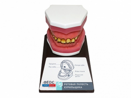 Демонстрационная модель "Ротовая полость курильщика" - fgospostavki.ru - Махачкала